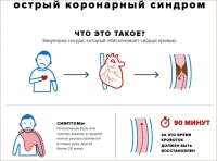 Острый коронарный синдром (ОКС)