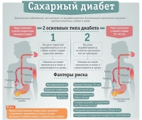 Сахарный диабет